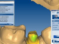 Szkolenie pracowników kierunku technik dentystycznych z systemu CAD CAM firmy Zirkonzahn